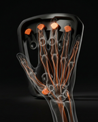 X-ray style hand anatomy showing tendons engaged by the finger trainer