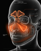 Diagram showing the heated mask warming the frontal, ethmoid and maxillary sinuses