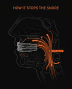 Anatomical diagram of how the mouth guard opens the airway to stop snoring