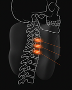 Diagram showing the neck cushion relieve pressure the cervical spine vertebrae