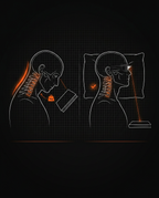 Diagram contrasting neck strain reading down versus relaxed prism glasses use