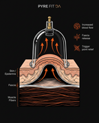 Diagram of a cupping cup relieve pressure skin, fascia and muscle layers