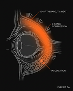 Cross-section diagram showing heat, compression and vasodilation around the eye